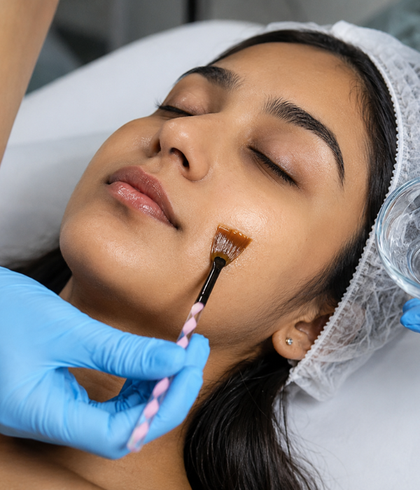 Chemical Peeling Treatment at Fortitude Dermatology Delhi