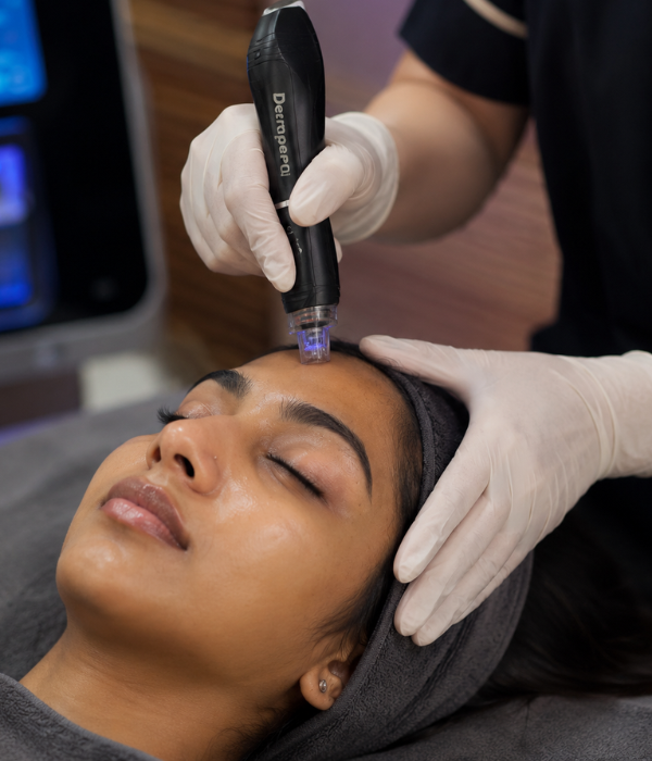 Micro Needling Treatment at Fortitude Dermatology Delhi