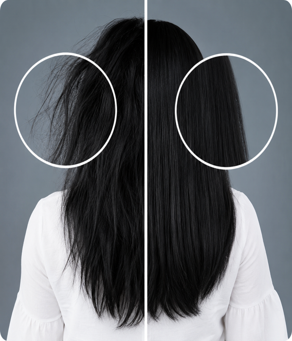 PRP Hair Treatment